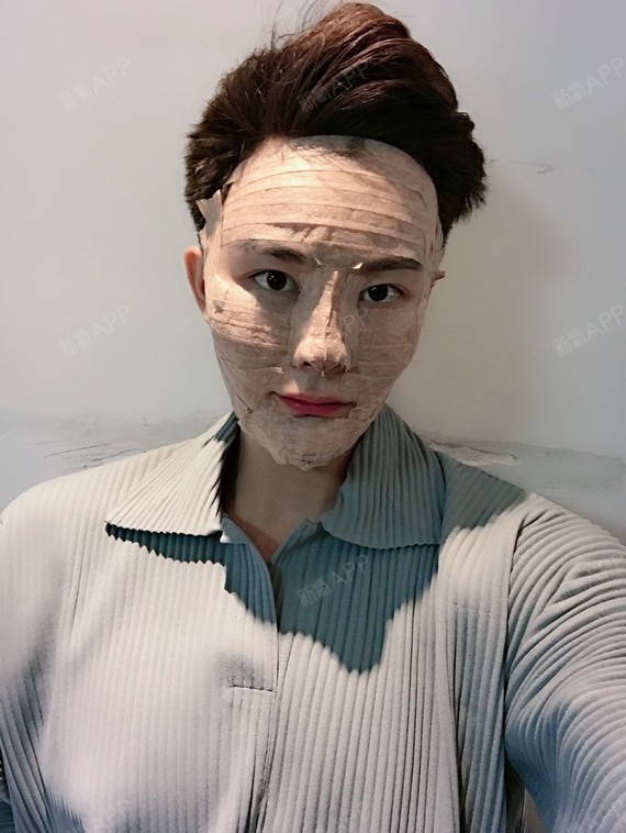 【北京艺美医疗美容诊所】【面部吸脂】【王东整形】【全面部吸脂】