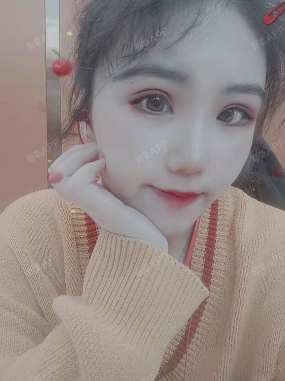 【青岛伊美尔5s重睑术 超微创开内眼角】不知不觉已_圈子-新氧美容