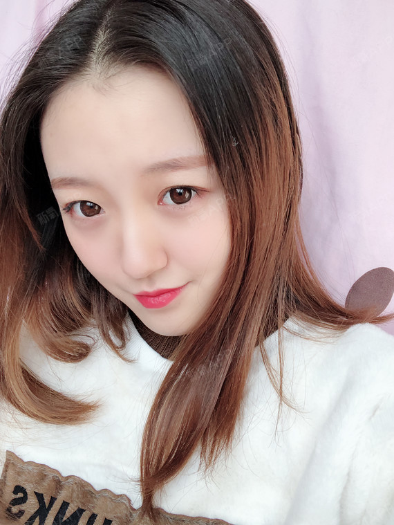 硅胶隆鼻好不好_效果图_气质妹子硅胶隆鼻术