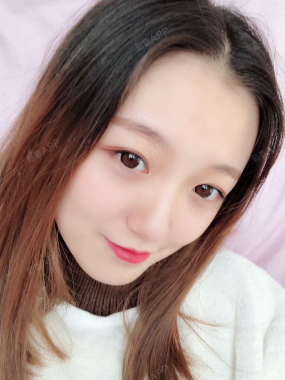 硅胶隆鼻好不好_效果图_气质妹子硅胶隆鼻术