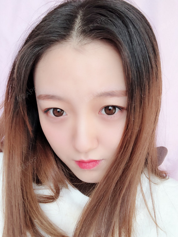 硅胶隆鼻好不好_效果图_气质妹子硅胶隆鼻术