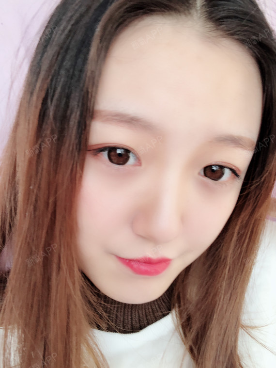 硅胶隆鼻好不好_效果图_气质妹子硅胶隆鼻术