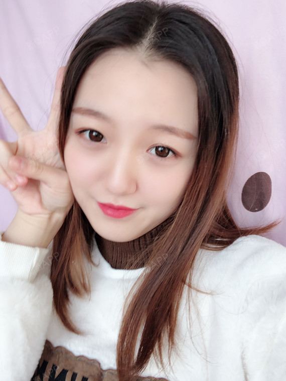 硅胶隆鼻好不好_效果图_气质妹子硅胶隆鼻术