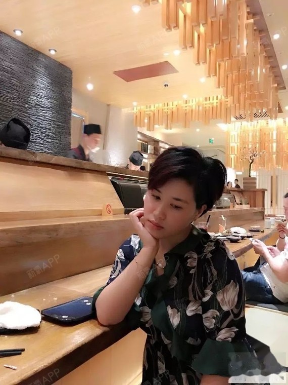 大龄骨性地包天矫正一年了。时间很快,虽然结