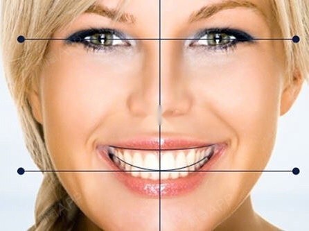 国际公认最美的牙齿笑线标准,照镜子对照一下!