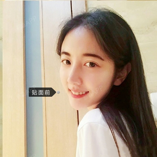 是什么让我遇见这样的你[:95][:94]--瓷贴面#从齿