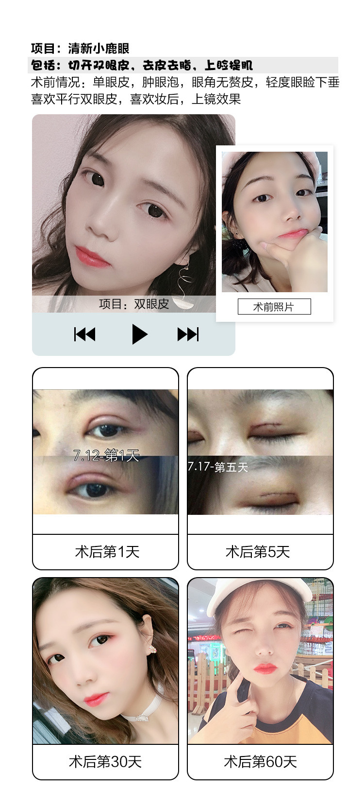 埋没 法 30 年 後 埋没法の糸は3 40年後にどうなるかについて教えていただきたいです