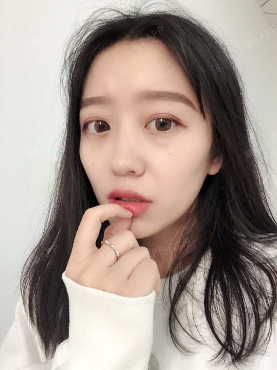 朋友说我做完双眼皮之后越来越调皮了,变的更可爱了人也更开朗