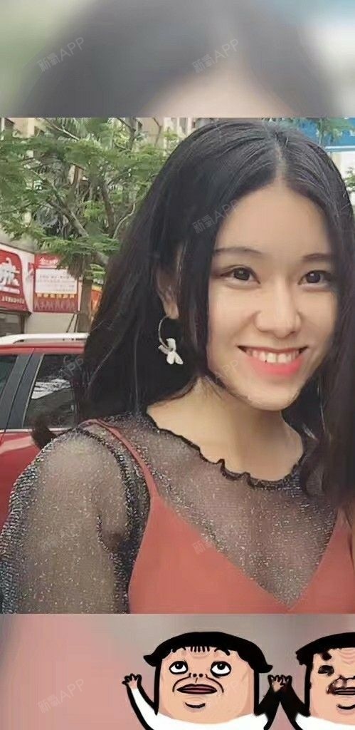 图片可以看出门牙是向内凹的.