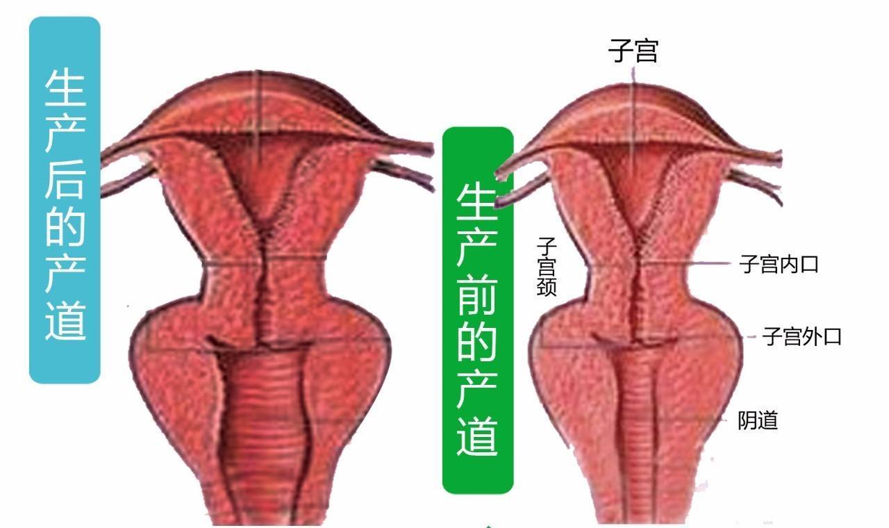阴道紧缩术可以有效的缓解漏尿的毛病改 新氧美容整形