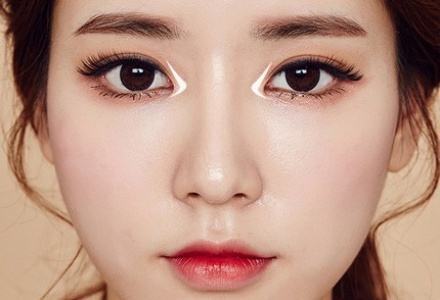 我眼睛天生很小,医生说我需要开外眼角?真的吗?