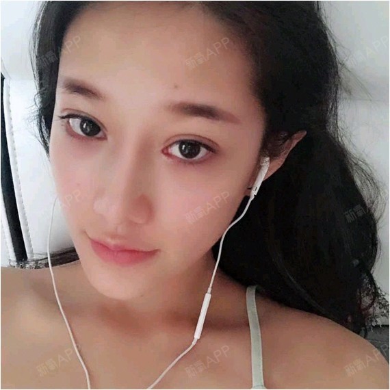 自体耳软骨隆鼻必看科普为什么选择三个月前;