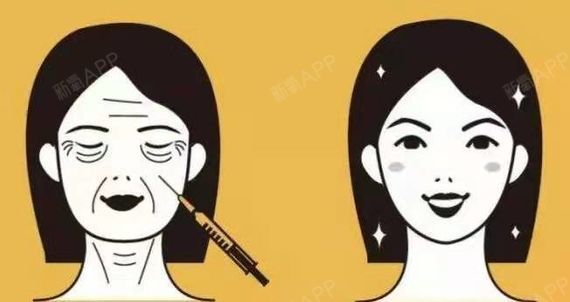 瘦脸针的危害有什么副作用_瘦脸针负面效果_瘦脸针的副作用会慢慢消失吗