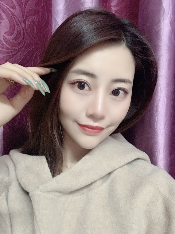 硅胶隆鼻能保持多久?可以永久不取出吗?硅胶