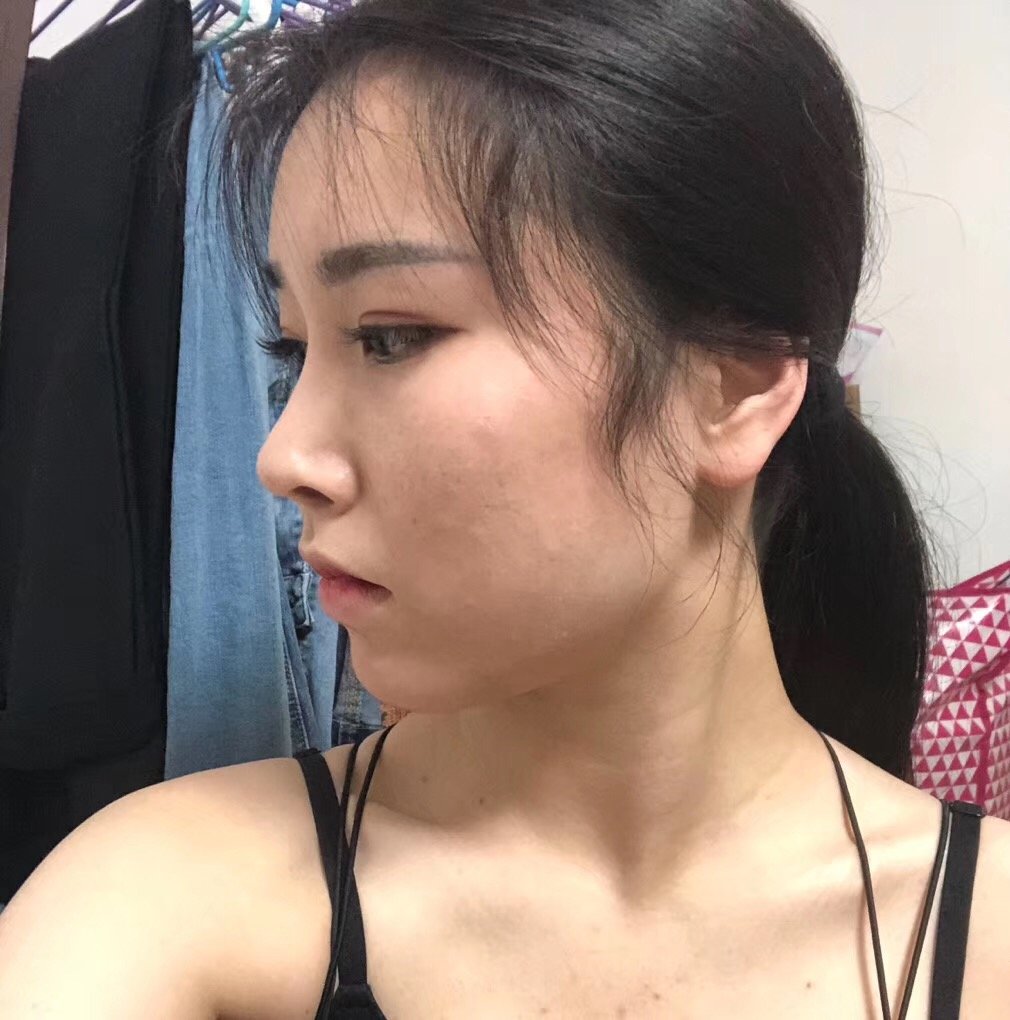 短鼻子的成长史