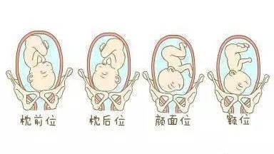 胎儿在子宫后壁的图图片