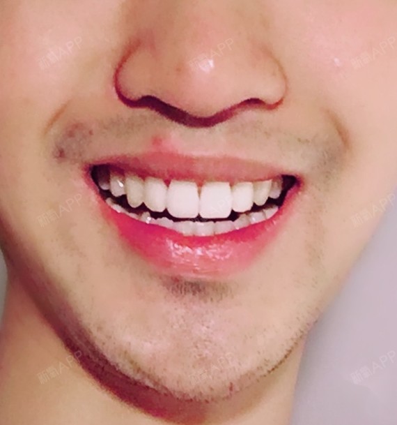 现在就剩24颗牙了.相对_圈子-新氧美容整形