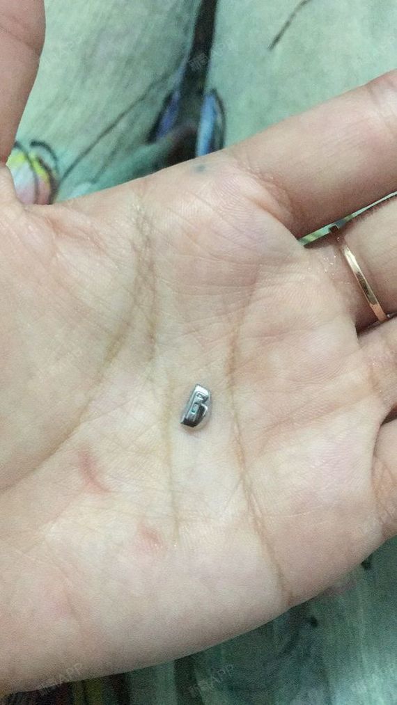 最近贴的托槽掉了,之前去医院粘的时候,花费了挺多时_圈子-新氧美容