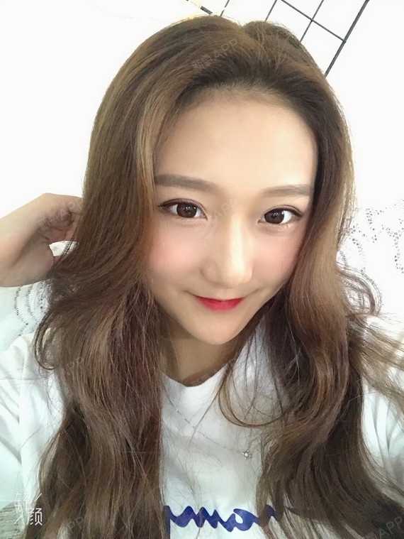 鼻子真的超级完美啊,脸蛋现在娇小玲珑的术后要护理好_圈子-新氧美容