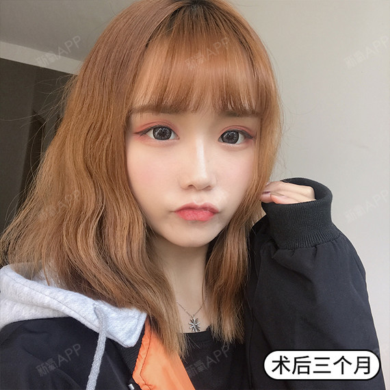 [:70]辟谣|瘦脸针打了会面瘫!?[:66]众所周知,瘦