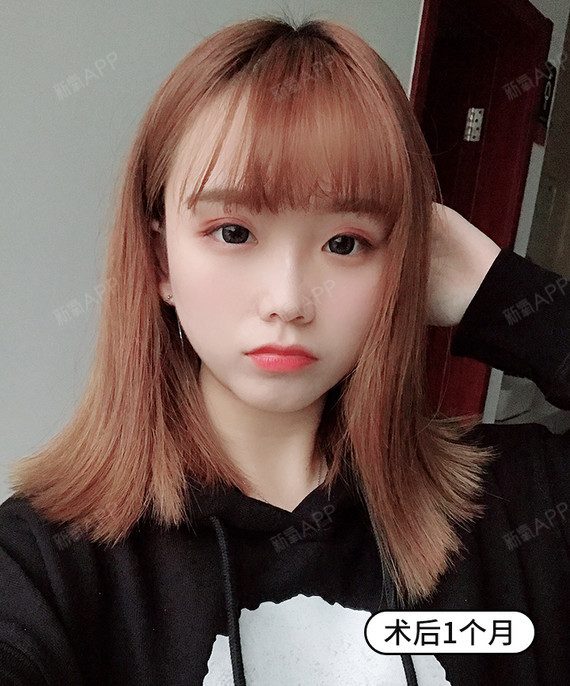 [:70]辟谣|瘦脸针打了会面瘫!?[:66]众所周知,瘦