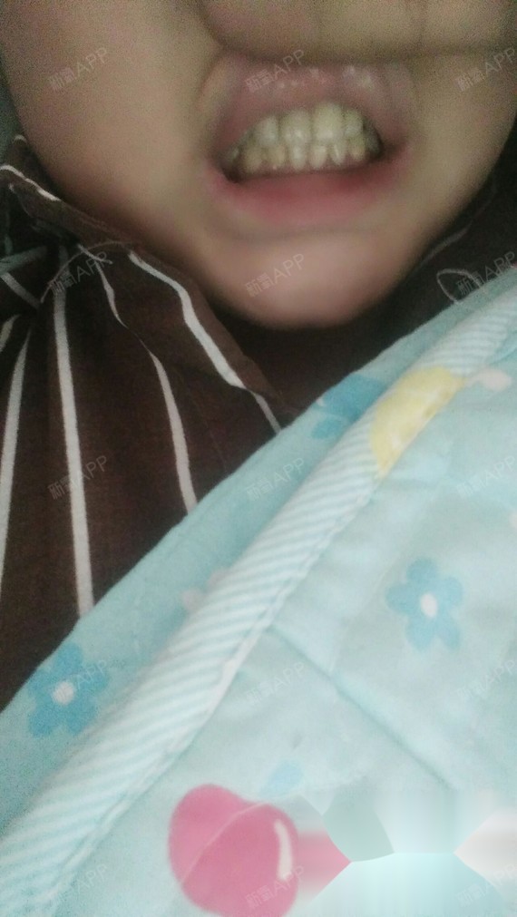 你猜我哪三颗门牙是假牙