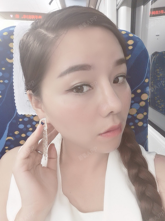 首页 此页面仅支持预览 Avatar 靖哥哥的大蓉儿 29篇日记 爱思特 芭比三体真鼻术 现如今做鼻整形的人络绎不绝 做鼻 修复的也越来越多 特别是每年的寒暑假都是鼻修复的高峰时期 这就会产生一个最新问题 到底人的鼻子一生中能经得住几次隆鼻呢