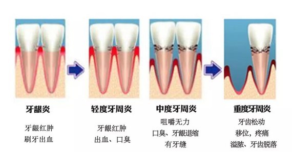 中年男人掉门牙什么预兆（中年男人掉门牙什么预兆图片） 中年夫君

掉门牙什么预兆（中年夫君

掉门牙什么预兆图片） 卜算大全