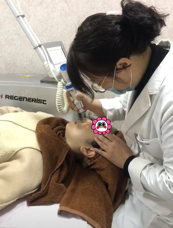 【悦可医美】【调q激光去斑第0天】我皮肤从小到