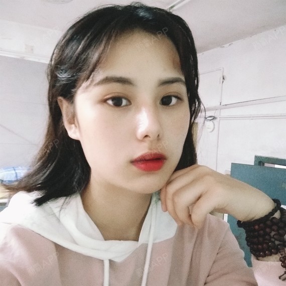 激光祛斑好不好_效果图_鸭梨大大大大呀激光