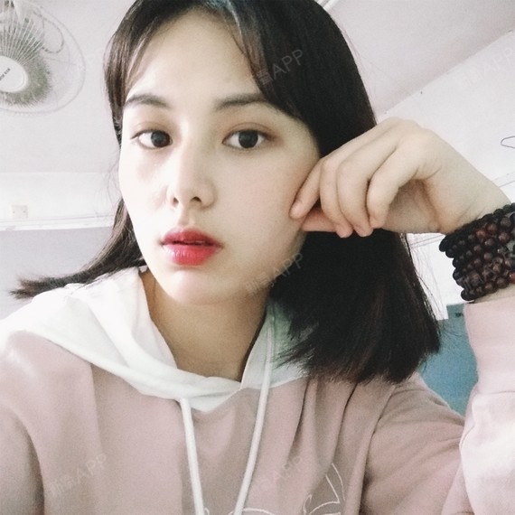 激光祛斑好不好_效果图_鸭梨大大大大呀激光