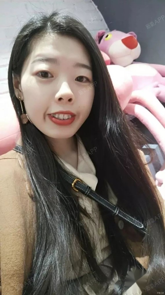 但是一直没行动,直到有一天被自己丑哭了,就下定决心,必须整牙