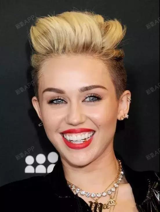 牙套也能玩转泫雅风!