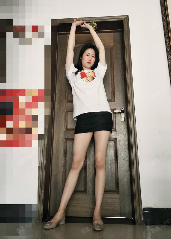 大腿吸脂 小腿瘦腿针半年啦!~emm,今天拍了一组_圈子-新氧美容整形