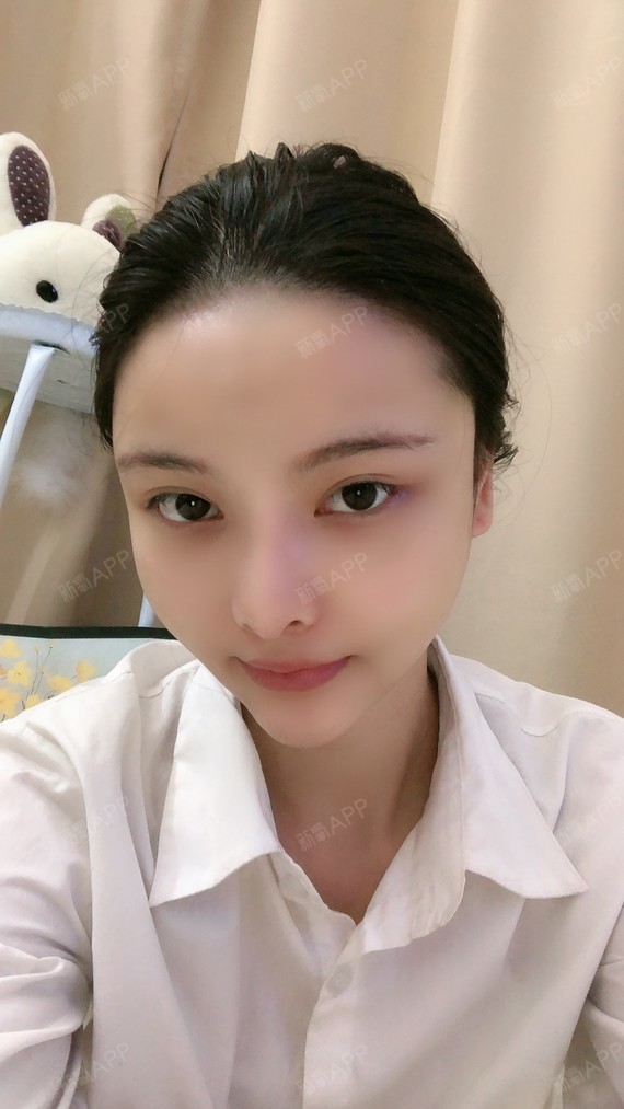 护士小姐姐手很_圈子-新氧美容整形