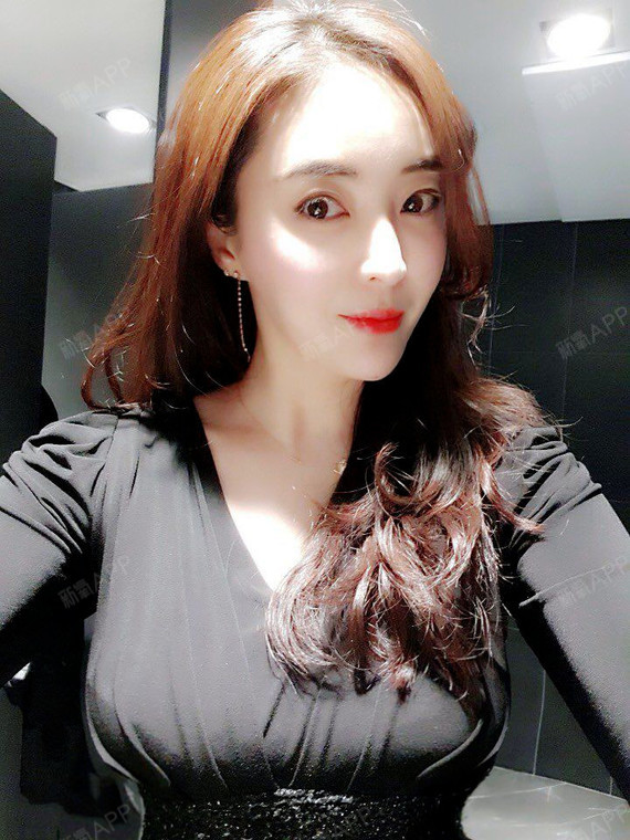 xtra记忆假体隆胸-300cc-韩国欧佩拉- 术后7个月恢复情况