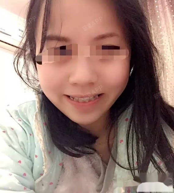 发个励志点的也想鼓励在犹豫不决的人们小时候12岁遇_圈子-新氧美容