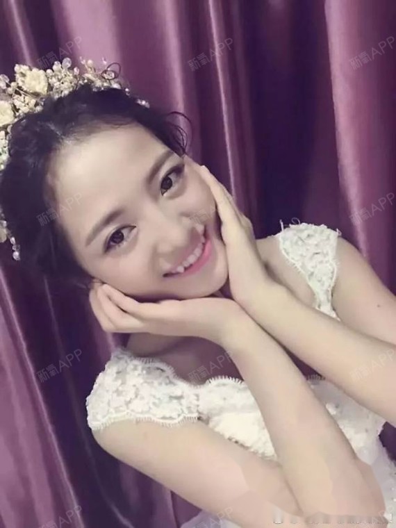 小虎牙,都说胖子都是潜力股,其实带牙套的小仙女们更是潜力股!