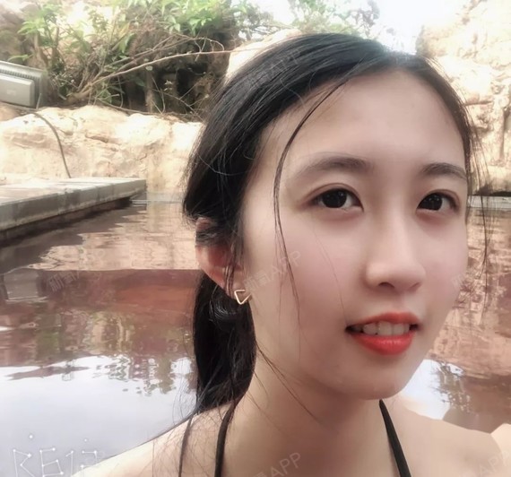 戴了牙套也不觉得丑 我觉得牙套吧,除了能矫正你的牙齿.