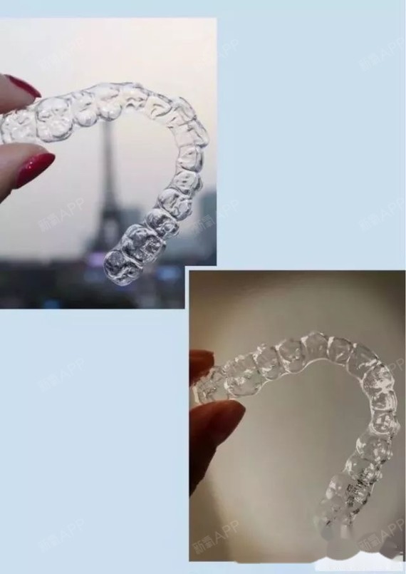 国产正雅隐形牙套,10个月完成矫正,效果非常满意国_圈子-新氧美容整形