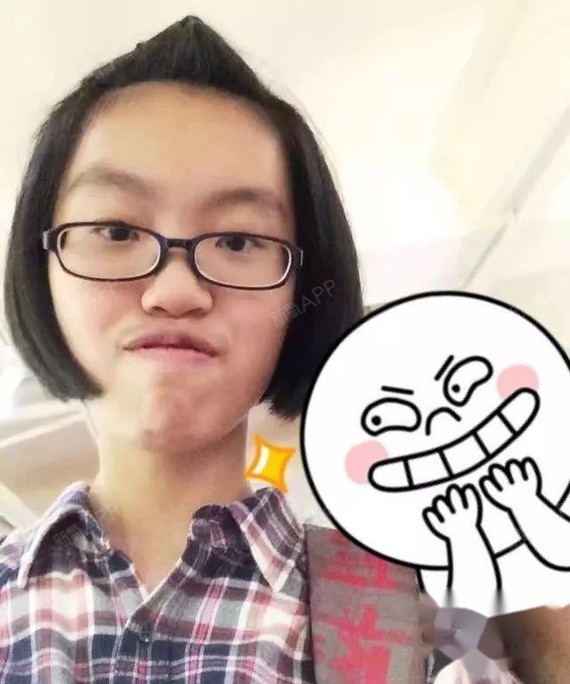 龅牙,牙床窄,笑起来时嘴唇会卡在牙龈上,牙套后很多_圈子-新氧美容