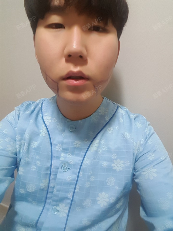 医院【韩国明星线整形外科】