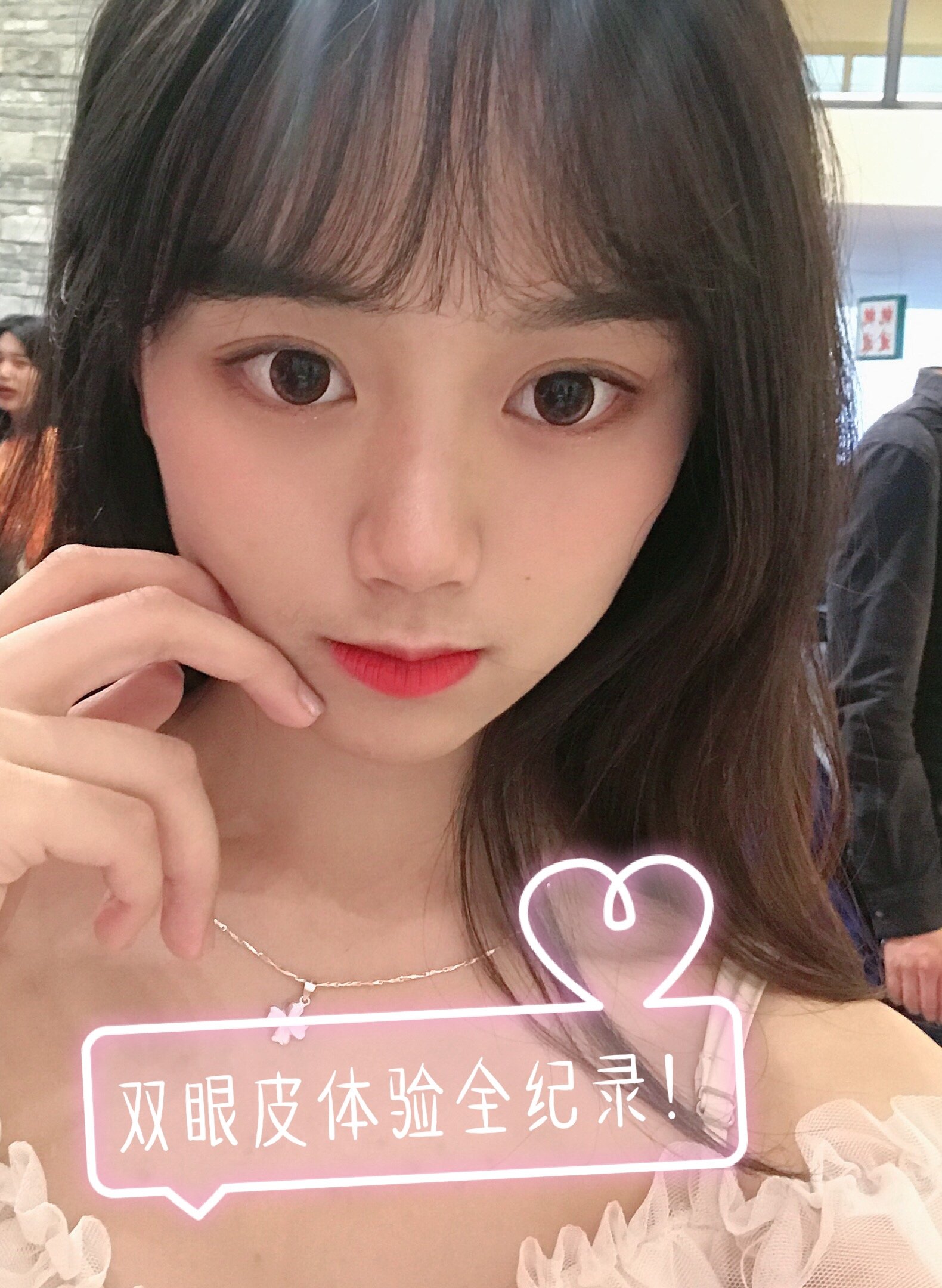 99【济南瑞丽】99双眼皮体验全纪录9197我是一名在校大_圈子