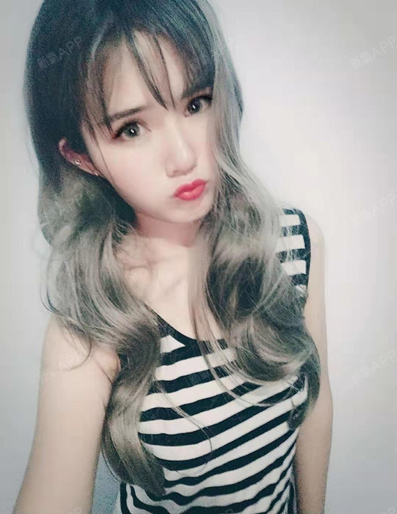 济南眼部多项好不好_效果图_沐晨夕fighting眼部多项术后第308天_新氧