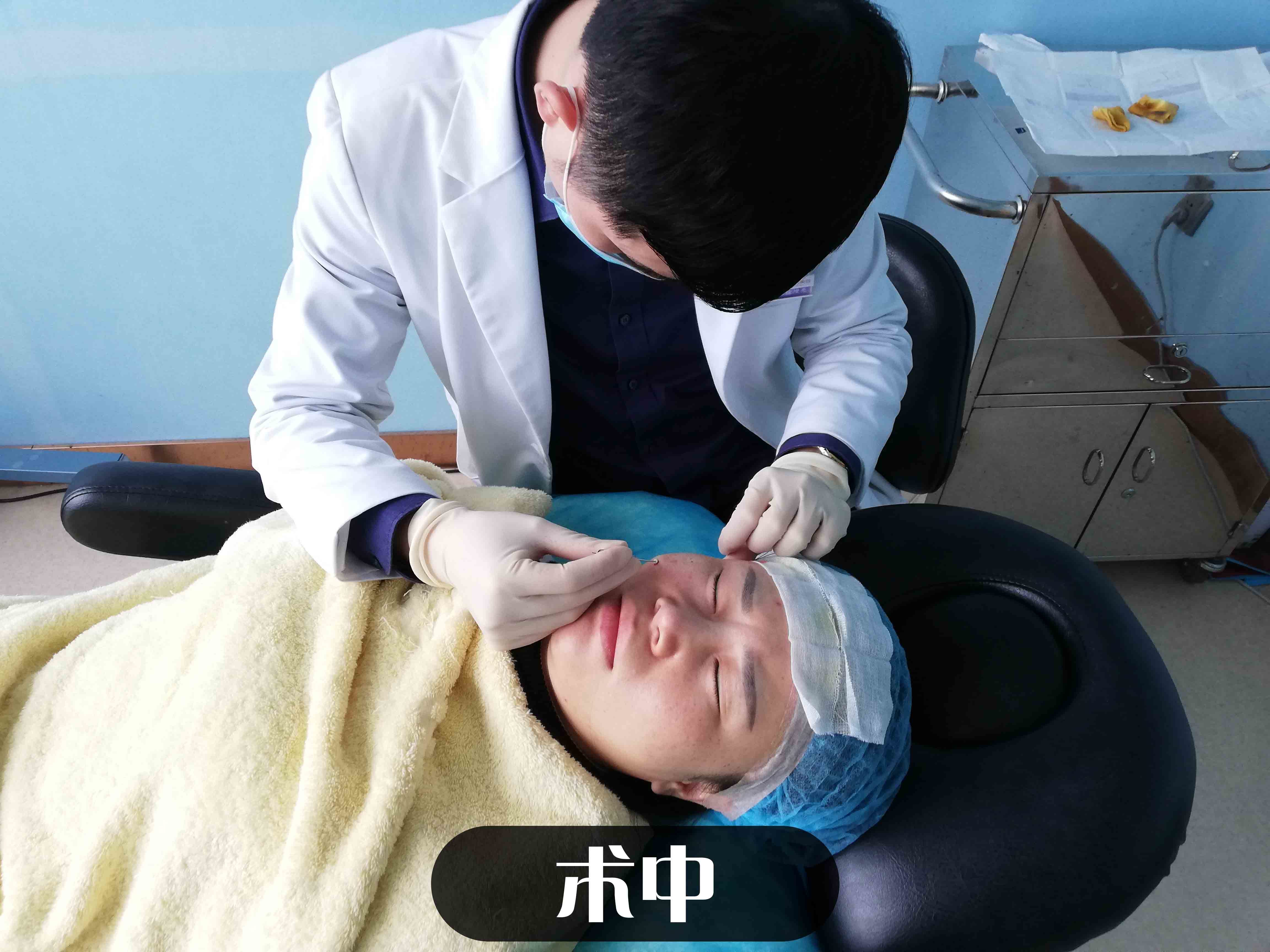 项目:全面部线雕