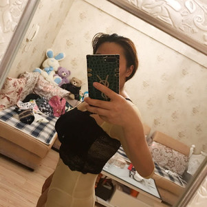 已经半个多月了,束身衣每天都有穿,据说是为了避免吸脂后出现凹凸不平
