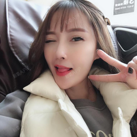 想割双眼皮很多年,却又犹豫不决的妹子们,大概