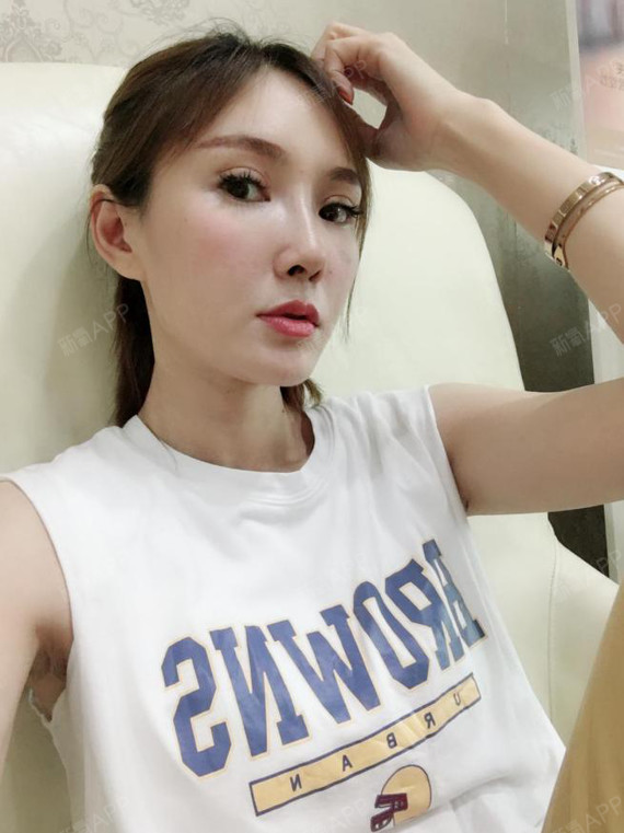 想割双眼皮很多年,却又犹豫不决的妹子们,大概