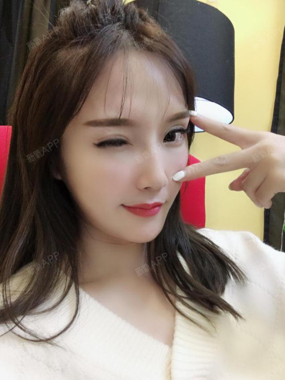 想割双眼皮很多年,却又犹豫不决的妹子们,大概