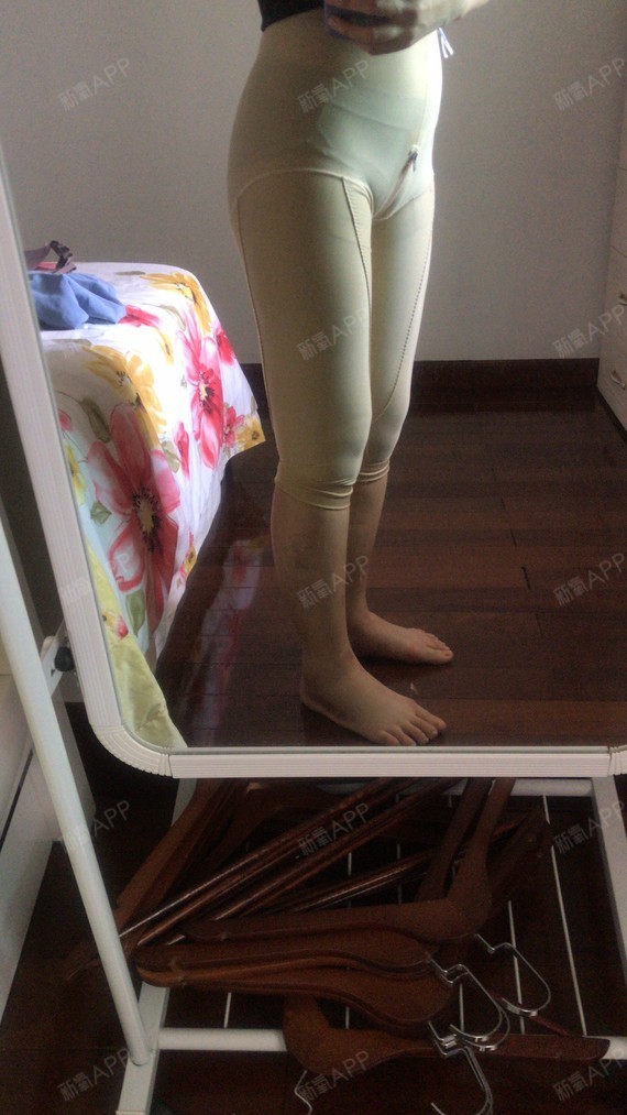 记录一下吸脂的第七天,腿上的淤青已经消退了不少,估_圈子-新氧美容
